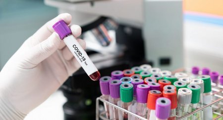 Azərbaycanda daha 104 nəfərdə koronavirus aşkarlanıb, 1 nəfər ölüb