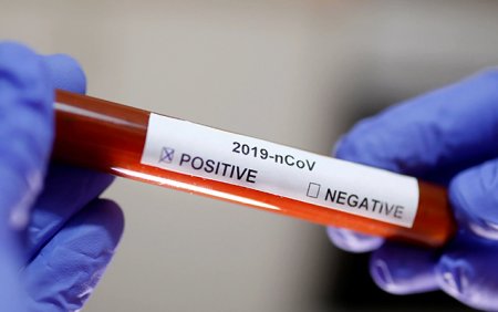 Azərbaycanda daha 49 nəfərdə koronavirus aşkarlandı - 