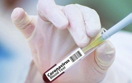 Azərbaycanda daha 67 nəfərdə koronavirus aşkarlandı - 