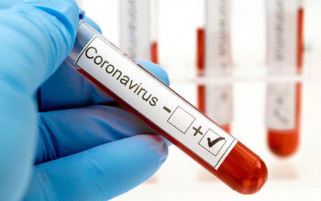 Rusiyada koronavirus üçün peyvəndin ilk sınağı başa çatıb