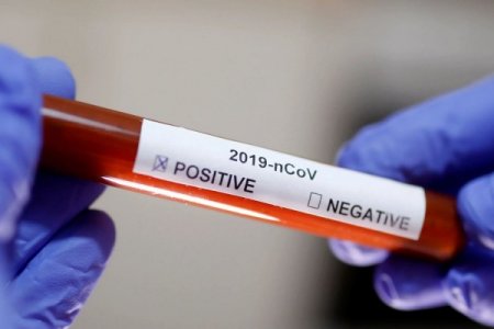  Ukraynada koronavirusa yoluxanların sayı artdı
