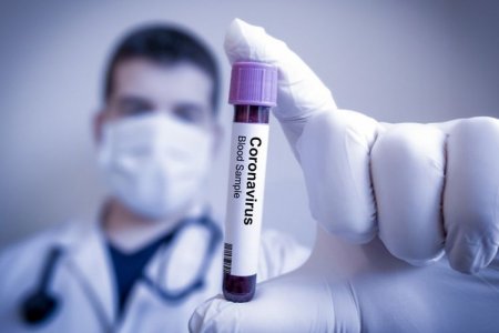 Azərbaycanda indiyədək 885 279 koronavirus testi aparılıb