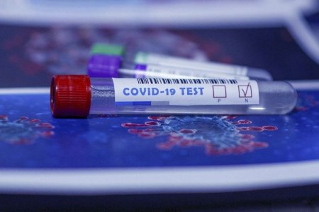 Azərbaycanda indiyədək 1027685 koronavirus testi aparılıb