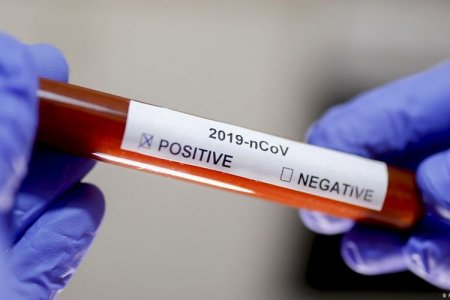 Gürcüstanda 227 nəfər koronavirusa yoluxub