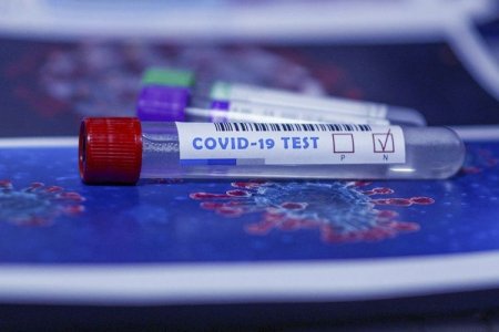  ﻿ Azərbaycanda indiyədək 1150658 koronavirus testi aparılıb