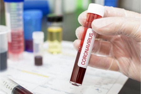 Azərbaycanda indiyədək 2 279 907 koronavirus testi aparılıb
