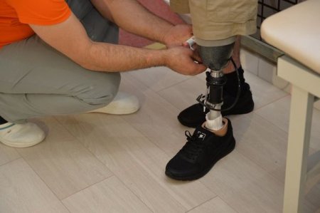25 qazi yüksək texnologiyalı protezlə təmin edildi