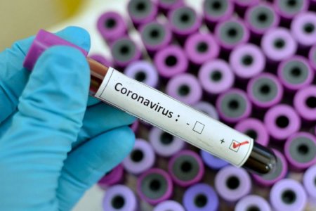 Son sutkada neçə nəfər koronavirusa yoluxub?