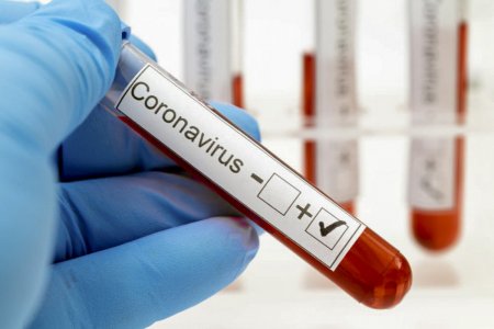 “Koronavirusdan ölənlərin 90%-dən çoxu peyvənd olunmayanlardır”