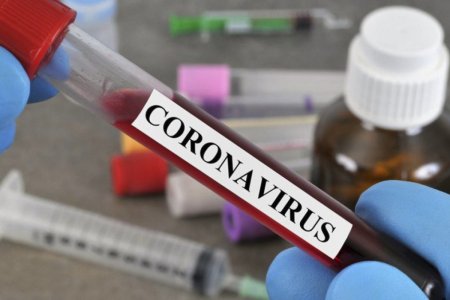 Rusiyada daha 1028 nəfər koronavirusdan ölüb