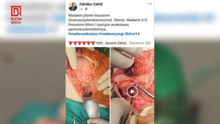 Cərrah Zahid Zahidovun əməliyyat görüntülərini paylaşması ilə bağlı  