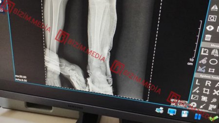 Lənkəranda qandonduran HADİSƏ – 