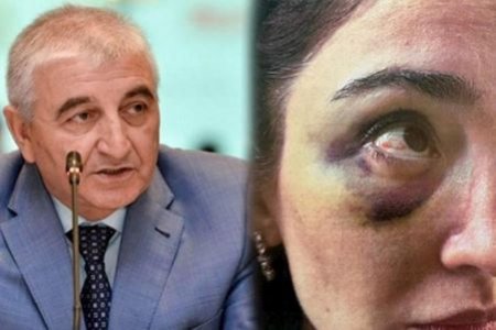 “Növbəti işgəncədən sonra pasportumu götürüb qaçdım” -