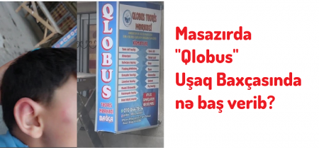 Masazırda "Qlobus" uşaq baxçasında körpəyə şiddət göstərilib?