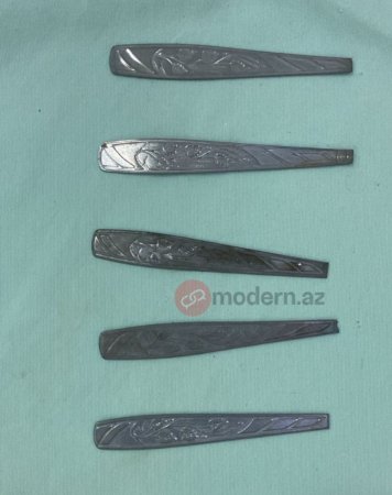 Bakıda bir nəfər 9 ədəd qaşıq uddu -  