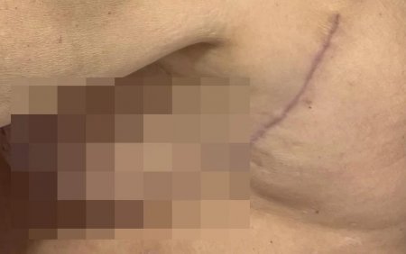 “Həkim məni 3 dəfə əməliyyat edib pis vəziyyətə qoydu” -  