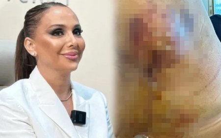 “Həkim məni 3 dəfə əməliyyat edib pis vəziyyətə qoydu” -